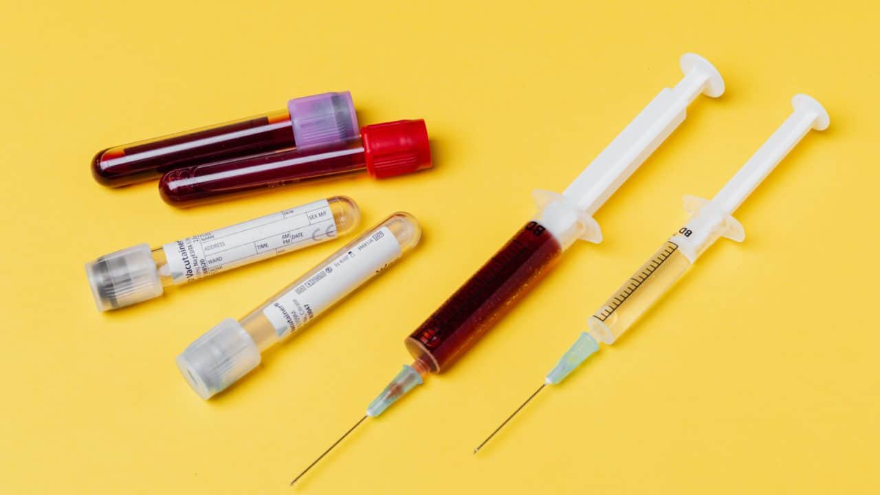 https://digitalhealthbuzz.com/wp-content/uploads/2020/07/syringes-and-test-tubes-with-blood-samples-4210610-1280x720.jpg