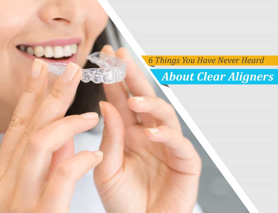 https://digitalhealthbuzz.com/wp-content/uploads/2021/02/6-Things-You-Have-Never-Heard-About-Clear-Aligners-940x720.jpg