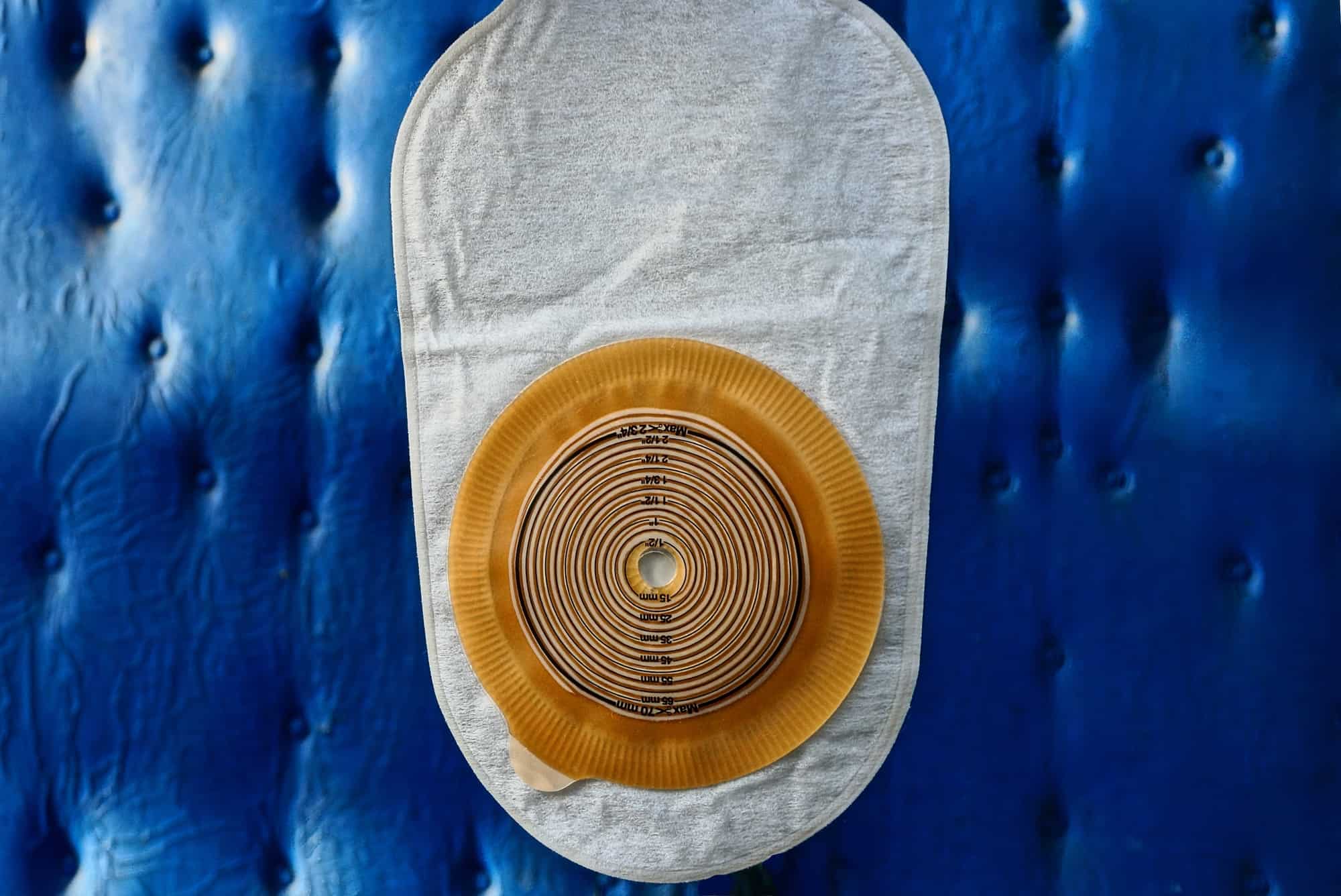 Tips And Tricks To Adapt To Life With An Ostomy Bag Digital Health Buzz!