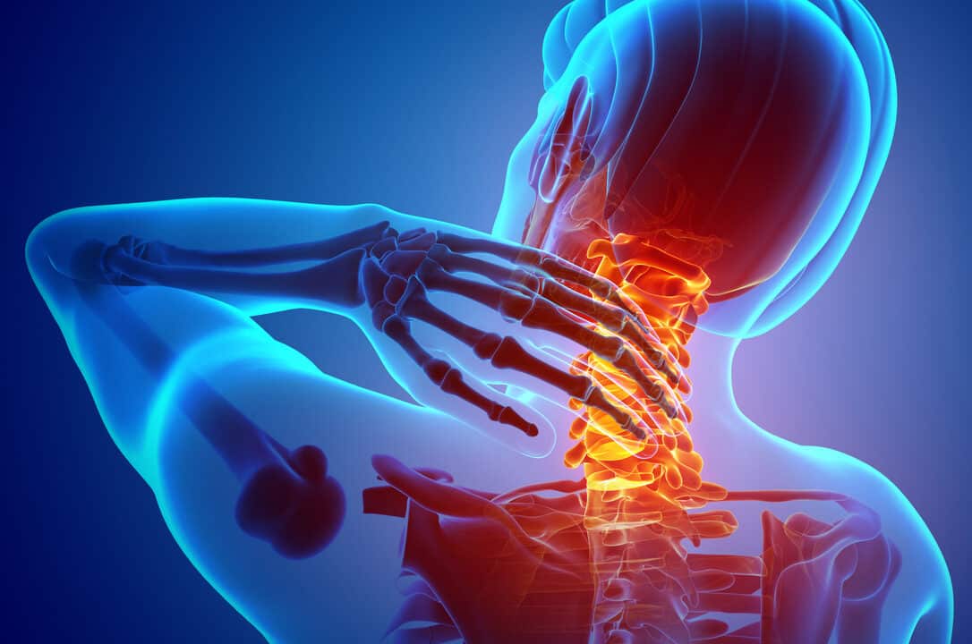 https://digitalhealthbuzz.com/wp-content/uploads/2022/05/neck-pain-fast-cure-calgary-physiotherapy-1086x720.jpg