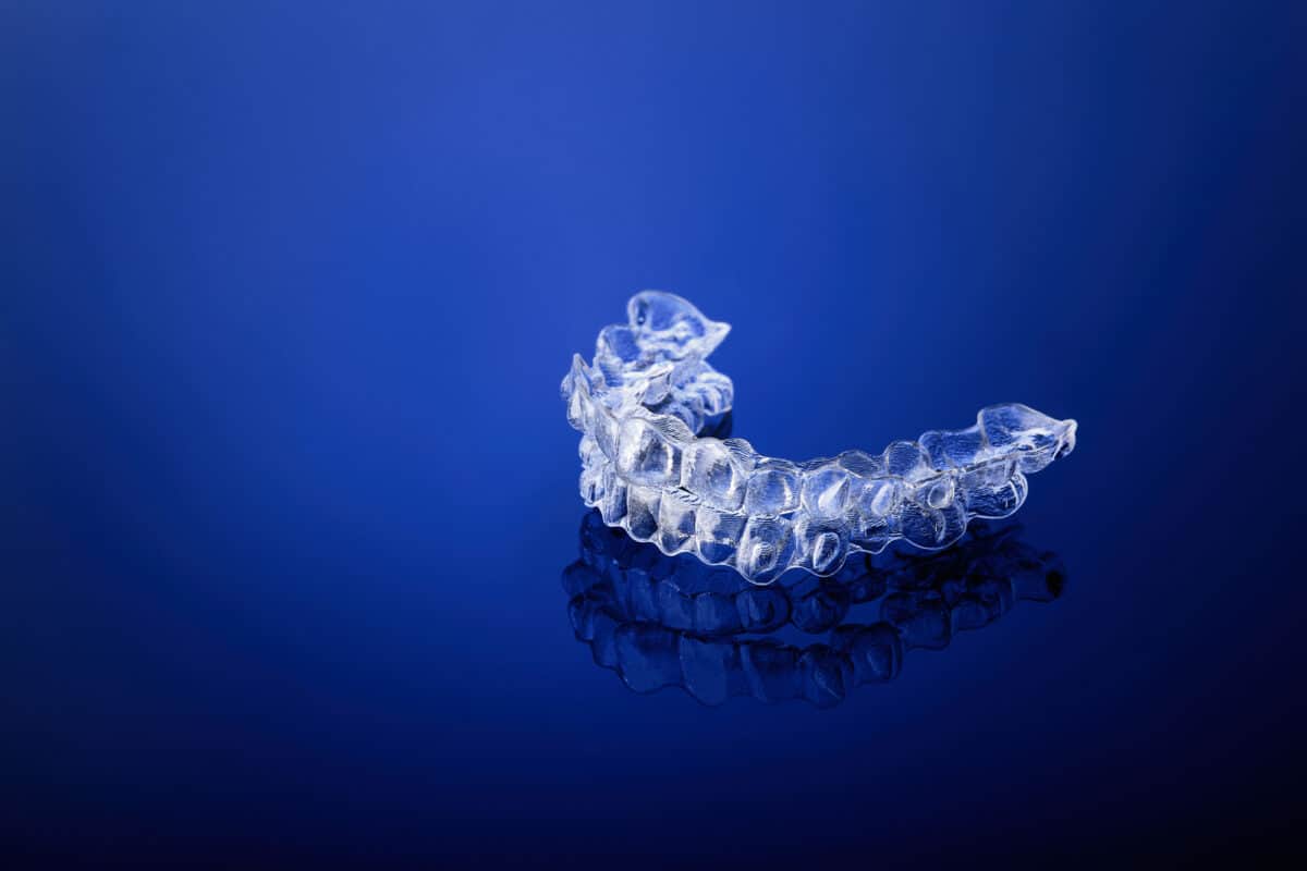 Are Aligners Worth the Cost?
