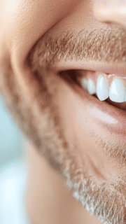 How All-on-4 Differs From Dentures